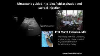 Intraarticular Shoulder Injection [upl. by Eninnej369]