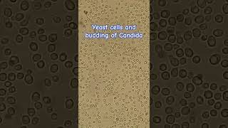 Yeast cells and budding of Candida [upl. by Irihs]