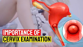 How to Test Your Cervix for Pregnancy at Home  Importance of Cervix Examination for Womens Health [upl. by Etteval]