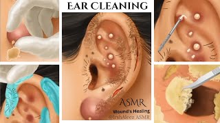 ASMREar Cleaning👂Ear WaxingInternal Ear CleaningPimple PoppingWounds HealingEarwax removal [upl. by Imelda]