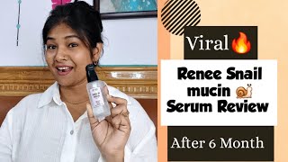 Gamechanging secrets of Snail 🐌 Mucin Serum  Renee Snail 99 Mucin refreshgallery snailmucin [upl. by Hourigan]