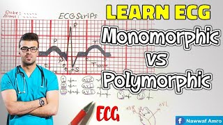 راجع معلوماتك و تعلم Ventricular Tachycardia VT Monomorphic vs Polymorphic Learn ECG [upl. by Capwell]