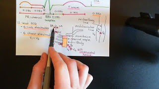 The Electrocardiogram ECG Part 3 [upl. by Othelia527]