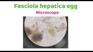 Fasciola hepatica [upl. by Anos]