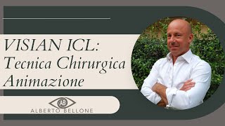 VISIAN ICL Tecnica Chirurgica Animazione [upl. by Nicolle]