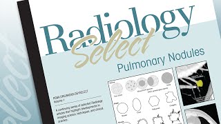 Radiology Select Volume 1 Pulmonary Nodules [upl. by Mellisa]