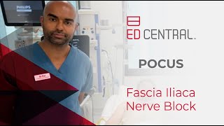 Fascia Iliaca Block POCUS [upl. by Timoteo740]