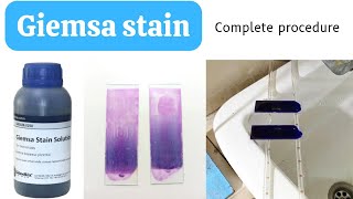 Giemsa Stain Procedure for Blood SmearHow to do Giemsa StainGiemsa Staining ProcedureAdnanMLT [upl. by Hollerman]