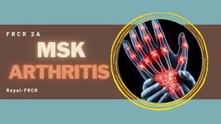 11  MSK amp Trauma Imaging for FRCR [upl. by Besnard326]