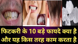 Fitkari treatment फिटकरी के 10 बडे फायदे क्या है जानीऐ इस वीडियोज मे। [upl. by Radferd]