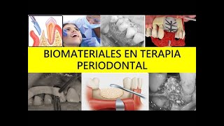 quotBIOMATERIALES EN TERAPIA PERIODONTALquot [upl. by Aidnic]