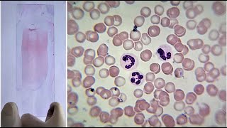 Blood Smear Preparation and Staining Practical Lab [upl. by Converse]