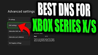 Best DNS Server For Xbox Series XS Faster internet for FREE by changing this one setting [upl. by Paderna338]