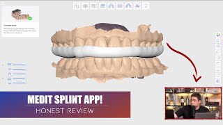 MEDIT Splint App  Diseño CAD Dental mediante Inteligencia Artificial [upl. by Alanah8]