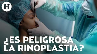 ¿No te gusta tu nariz La rinoplastia es la cirugía plástica más común conoce riesgos y cuidados [upl. by Pallas53]