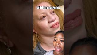 Understanding Albinism SHOWING how to learn and lash behind the scenes lashes [upl. by Sucramrej]