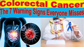 Silent Killers 7 Alarming Signs of Colorectal Cancer You Should Know [upl. by Ardnahcal]