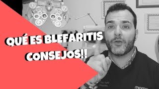 BlefaritisConoce Qué Ocurre En Tus Ojos  CONSEJOS [upl. by Sharla]