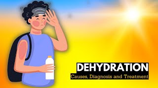 What is Dehydration Causes Signs and Symptoms Diagnosis and Treatment [upl. by Nirrep]