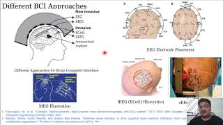 65 Recent Trends Microelectrode Arrays and Deep Brain Stimulation [upl. by Weslee]