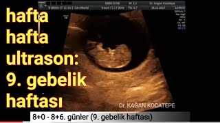 9 gebelik haftasında anne karnındaki bebek  açıklamalı ultrason görüntüleri [upl. by Peper422]