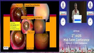 AIOCMTC2 2023 GP63 topic Dr Lalit Verma Intravitreal Injections in Endophthalmitis [upl. by Irpac]