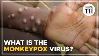 What is the monkeypox virus  The Hindu [upl. by Afatsom224]