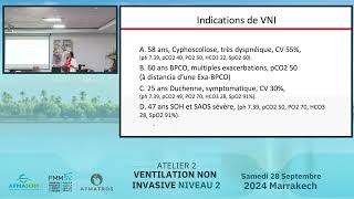 Comment régler un ventilateur  Modes deventilation modes de contrôle des cycles [upl. by Alan]