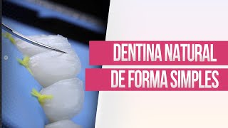 Como realizar caracterizações dentinárias [upl. by Ing]