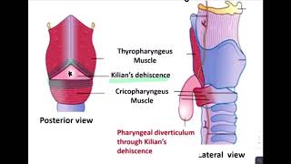 ESOPHAGEAL DIVERTICULUM [upl. by Nytsua]