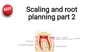 scaling and root planing part 2 [upl. by Christianson]