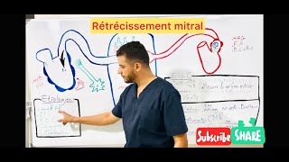 Rétrécissement mitral [upl. by Ydnec]