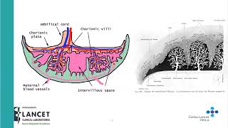 The Pathologist and the Placenta  Dr Zambuko [upl. by Besnard]