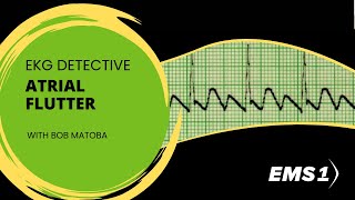 Atrial Flutter  EKG Detective [upl. by Thielen]