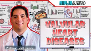 Valvular Heart Diseases  Clinical Medicine [upl. by Necyla]