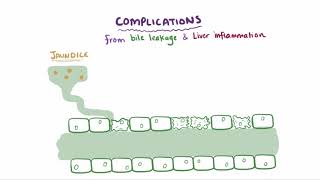 Primary biliary cholangitis causes symptoms diagnosis treatment amp pathology [upl. by Eudora]