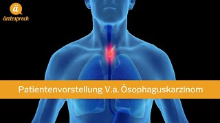 FSP Patientenvorstellung Ösophaguskarzinom [upl. by Ylloj644]