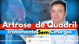 Artrose no Quadril 9 Dicas de Tratamento Sem Cirurgia [upl. by Ofella]