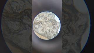 Human Skin Cells Under Microscope magnification microscope science shorts sciencelab [upl. by Harv]