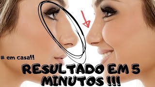 INFALÍVEL Rinoplastia EM CASA SEM GASTAR NADA [upl. by Charin]