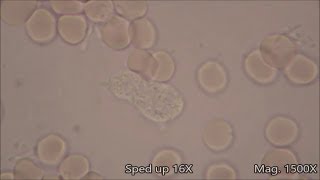 White Blood Cells under the Microscope [upl. by Eiddam211]