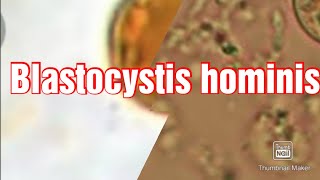 Skill Lab12 Blastocystis hominis [upl. by Ame]