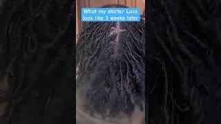 Starter Locs 3 weeks later locs youtubeshorts [upl. by Aerdnaz]