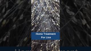 Home Treatment For Lice  Hair Regrowth  Hair Loss  Hair Tips  Adon Hair Care viralshort [upl. by Paehpos]