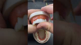 How teeth are designed hospital dentist teeth shortvideo shortsyoutube shorts [upl. by Maida]