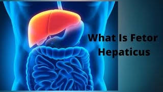 What Is Fetor Hepaticus [upl. by Sweatt]