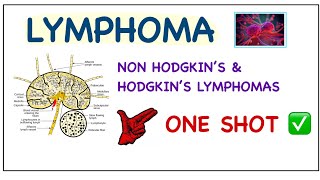 Complete LYMPHOMAS In ONE SHOT  Non Hodgkin’s amp Hodgkin’s Lymphoma  B Cell Neoplasms pathology [upl. by Edythe]