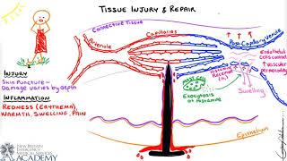 Tissue Injury amp Repair [upl. by Iveson]