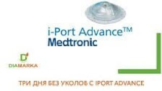 I PORT ADVANCE 3 [upl. by Edla]