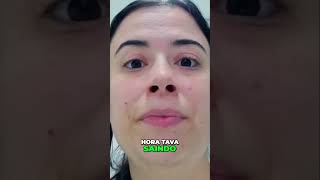 Facetas Dentárias O Que Você Precisa Saber Antes de Colocar [upl. by Nocaed]